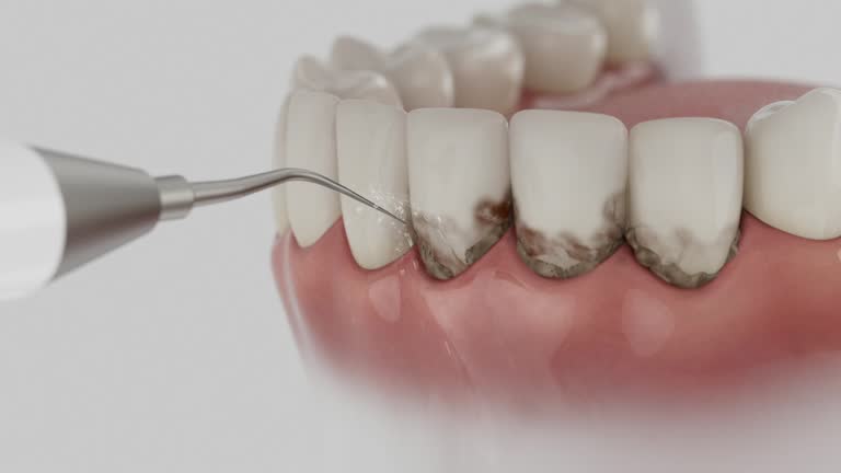Trusted Wisdom Tooth Removal service in Phenix City, AL - Dentist Open Now